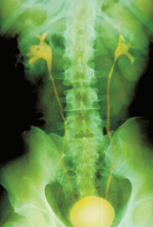 bladder