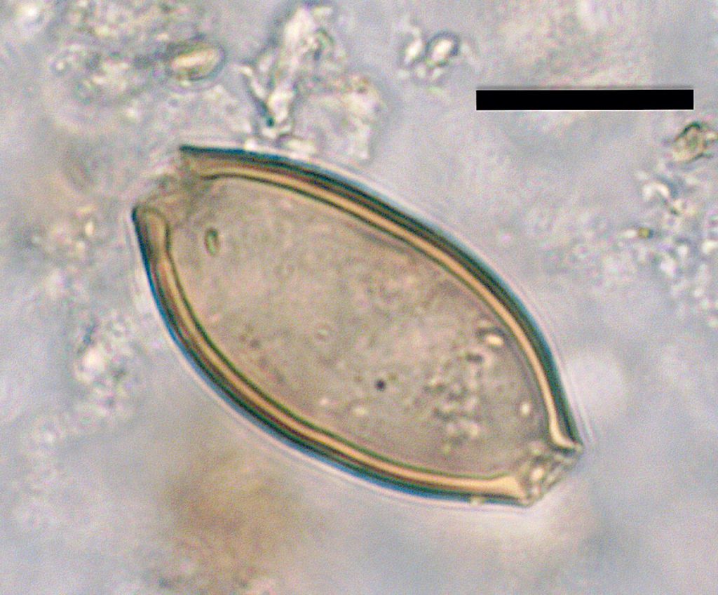 egg of whipworm