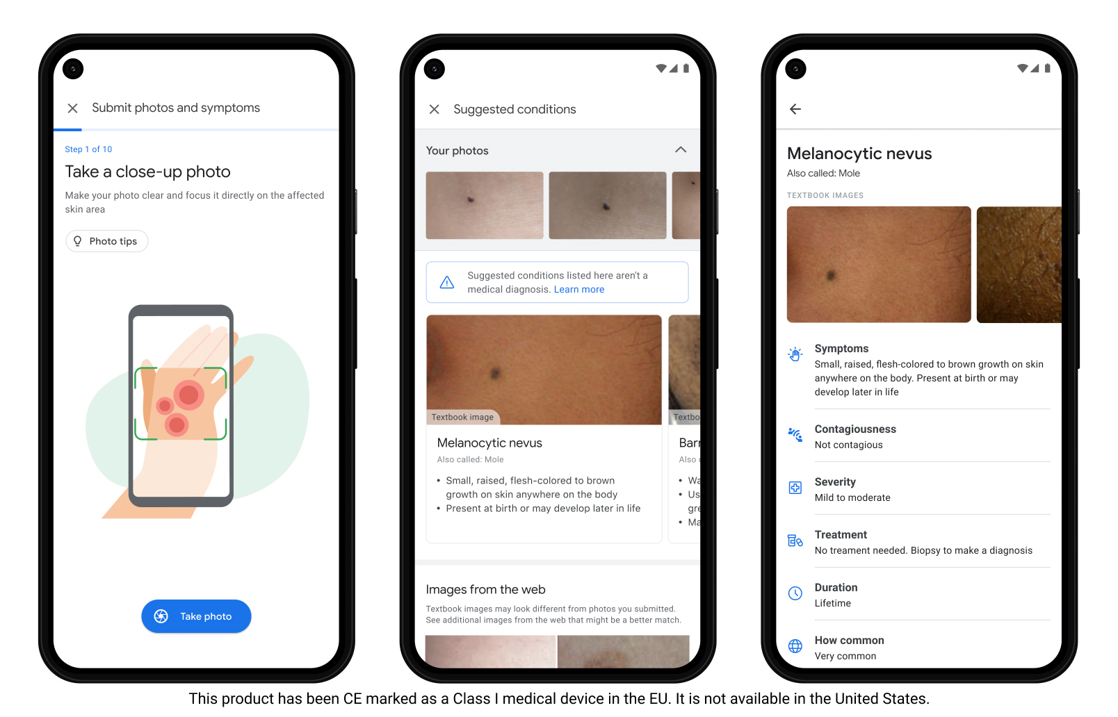google derm assist